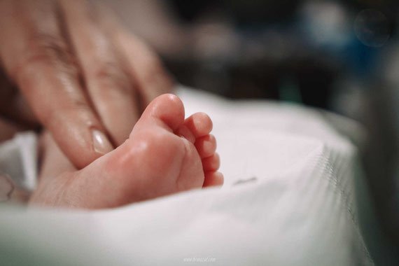 צילום בברית ללא הפרעה - תוצאה מדהימה